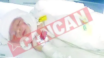 Bebelusul ars, operat a doua oara