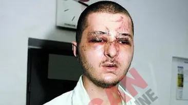 Au batut un om intr-un restaurant si nu pot fi identificati