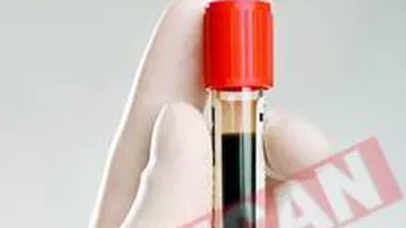 Expunerea la soare poate imbatrani prematur pielea