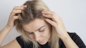 Când scalpul cere ajutor: dermatita seboreică și soluțiile naturale care pot calma pielea