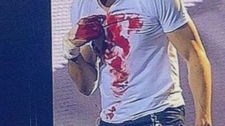 VIDEO! Se repeta istoria de la "Ferma Vedetelor!" Un celebru artist, plin de sange dupa un concert de groaza!