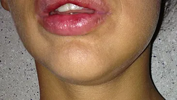 Scandal monstruos! Un campion naţional la motociclism a bătut-o în club pe Bianca Jurca până a mutilat-o. Vezi cum arată ea după