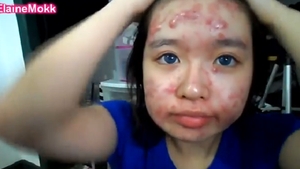 Transformare SOCANTA a unei fete care sufera de acnee! Cum reuseste sa scape de bubele inestetice de pe fata VIDEO