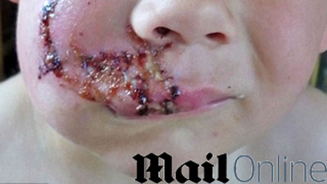 Un baietel de trei ani a fost desfigurat de un Labrador! Are 40 de copci si va ramane cu o cicatrice imensa