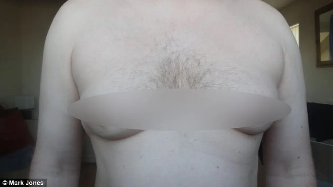 A vrut sa scape de sanii de femeie si sa arate ca un barbat normal! Rezultatul este insa INGROZITOR!