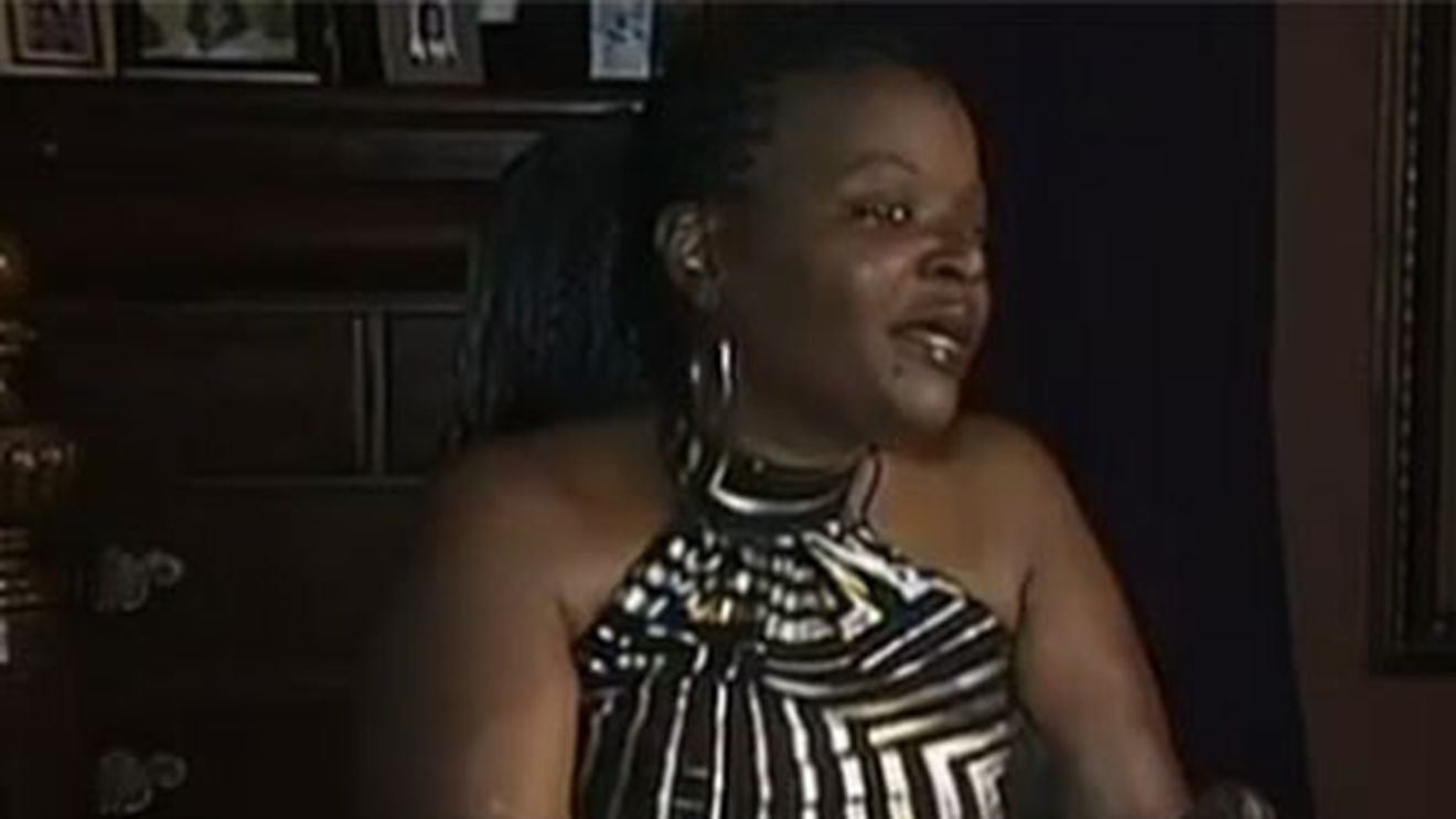 HACUITA de ESTETICIAN! I-au amputat mainile si picioarele dupa ce si-a pus silicon in fese! Imaginile HORROR care te vor bantui!