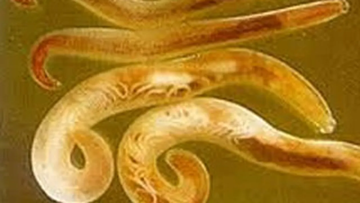 Un cuplu australian la un pas de moarte! Mancati din interior de un vierme cu dinti care s-a instalat in creier