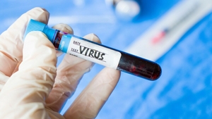 Virus transmis de rozătoare! Ce este hantavirusul și cât de periculos poate deveni