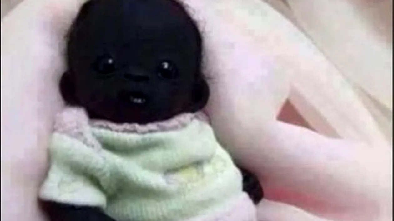 Vă mai amintiţi de Edam, cel mai negru bebeluş din lume? Iată cum arată acum, la 4 ani