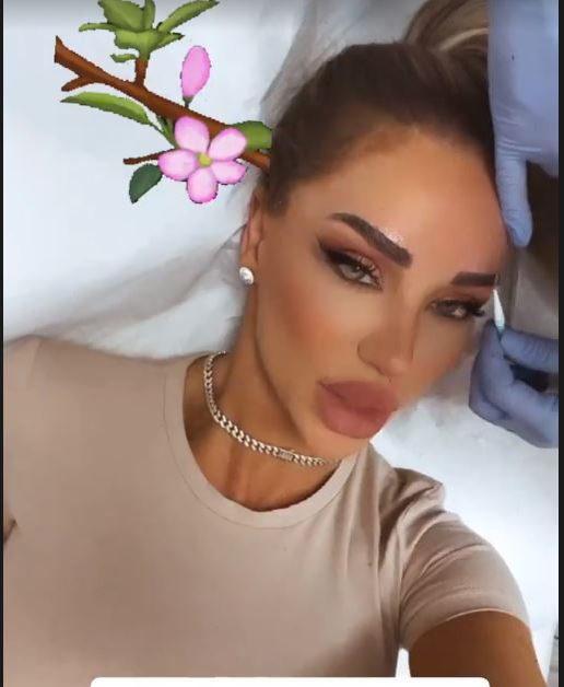 Bianca Drăgușanu, problemă delicată după o intervenție estetică: “Ce mi-o fi trebuit mie implant de sprâncene? O porcărie”