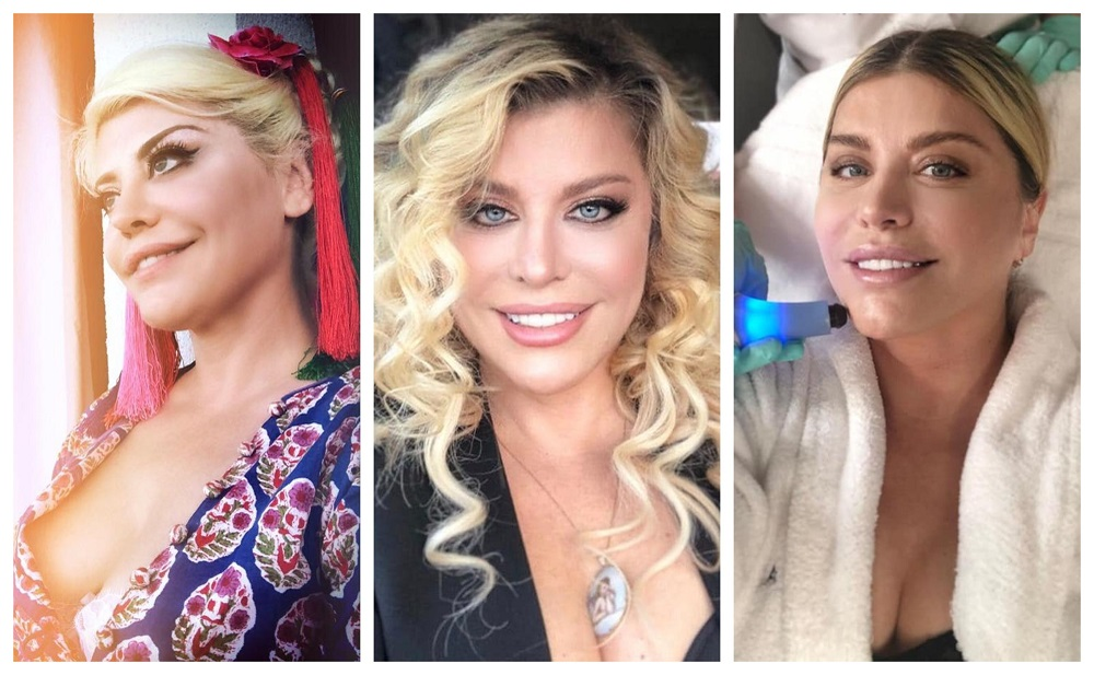 Loredana Groza a vorbit despre operațiile estetice pe care le are