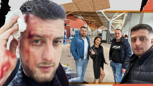L-a umplut de sânge în local! Imagini de coșmar cu saxofonistul lui Carmen de la Sălciua: 4 copci și dosar penal!