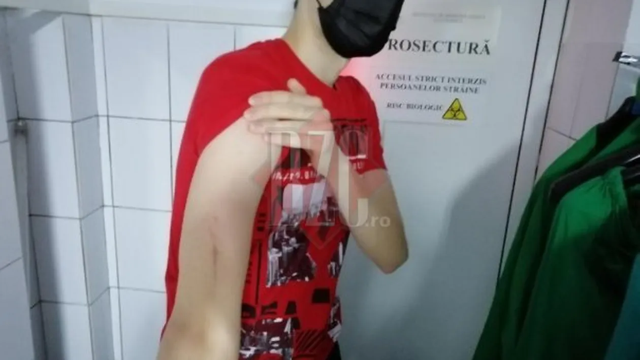 Un student, bătut pentru un loc de parcare în Cluj-Napoca de șoferul unui BMW. Agresorul nu este stăpân pe lotul pe care Andrei și-a pus mașina