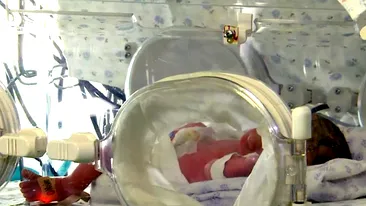 Caz unic în istoria omenirii: S-a născut primul bebeșul fără chip