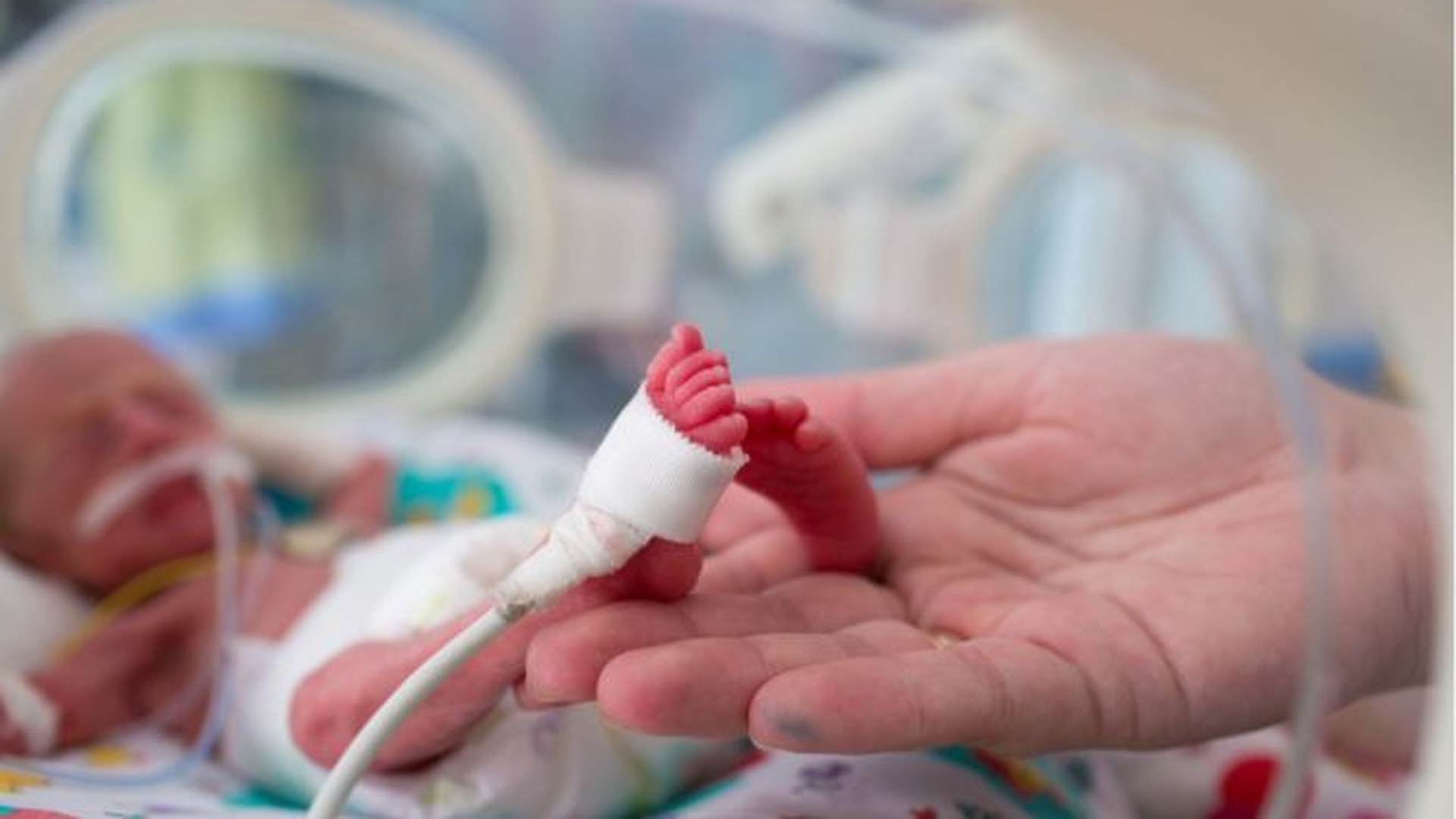 Cel mai mic bebeluș din lume, care cântărea 268 de grame, a supraviețuit! Cum arată acum