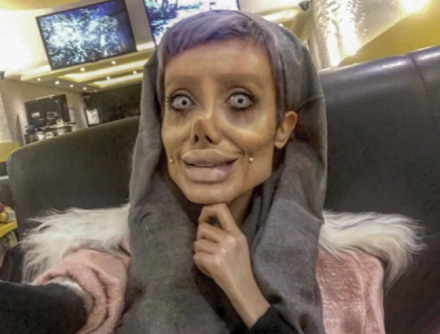 VIDEO & FOTO / O vedetă de pe Instagram a făcut 50 de operaţii estetice ca să arate precum Angelina Jolie! Rezultatul e înspăimântător şi nu are de gând să se oprească