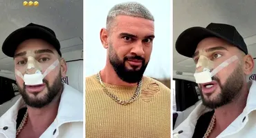 Dorian Popa, la un pas să îi „cadă nasul ca lui Michael Jackson”! Ce i-a descoperit medicul la operație? „Habar nu aveam”