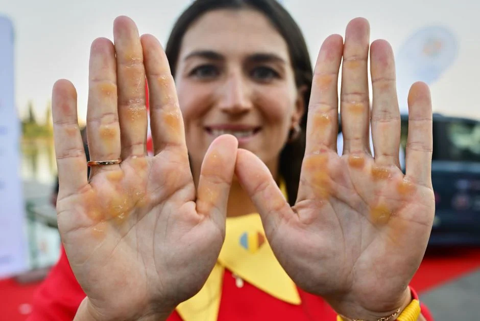 Imagini greu de digerat. Cum arată palmele canotorilor de la JO 2024. Ai curaj să le vezi?
