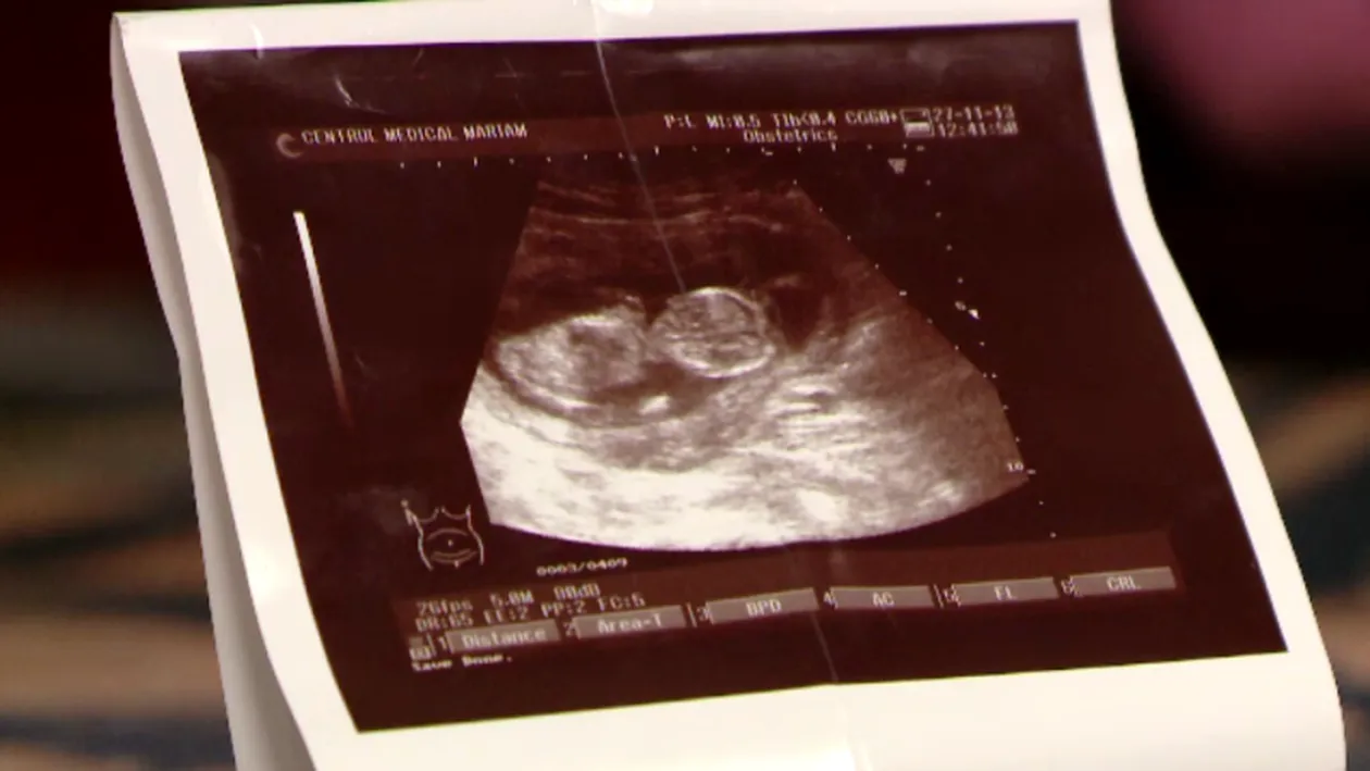 O gravidă din Timişoara a mers la ginecolog să facă avort, însă după câteva zile a constat că era tot însărcinată! Ce a urmat e copleşitor: E posibil sa fi scos doar...