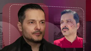 În ce stare se află Liviu Vârciu, după accidentul neaşteptat. Ce tratament strict i-au prescris medicii: “Un milimetru și îmi pierdeam ochiul”