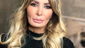 Daniela Gyorfi, nu te mai recunoaștem! Spui că nu te-ai operat, dar imaginile te dau în fapt