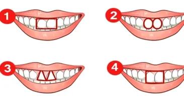 Test de personalitate inedit | Cum te caracterizează forma dinţilor? Spun totul despre tine