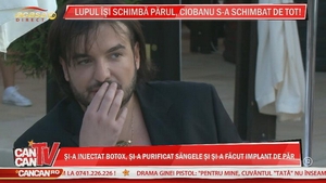 Ciobanu a intrat in renovare: implant de par, botox impotriva transpiratiei, tratamentul Dracula. Urmeaza o interventie la pometi