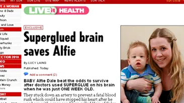 INCREDIBIL! I-au salvat viata unui bebelus cu ajutorul unui... superglue!