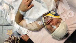 Batut mar in plina strada. Atacat de trei malaci, Andrei Tirdea a ajuns la spital aproape inconstient. Are capul spart in 3 locuri