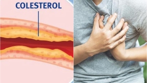 Dieta de doar 2 zile care contribuie la scăderea colesterolului. Cercetătorii germani o recomandă