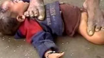 Tratament infricosator! Calca bebelusii pe gat pentru a-i trata de gripa