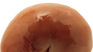 Vrei un rinichi? Ai nevoie de ficat? In Romania, organele se vand cu preturi cuprinse intre 25.000 si 40.000 de euro!