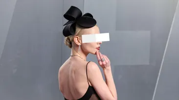 O actriță celebră a ajuns de nerecunoscut, iar fanii sunt extrem de îngrijorați. „Arată foarte nesănătos”