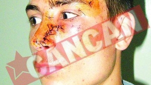 Mutilat cu un ciob, la discoteca