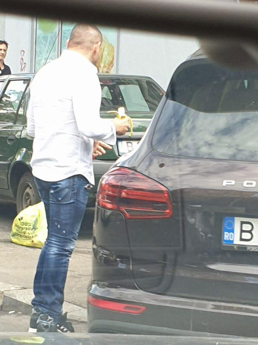 Lui Florin Pastramă i-a eşuat implantul de păr!