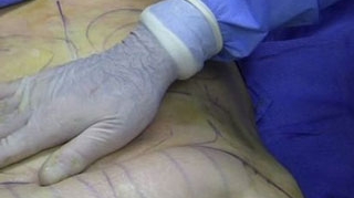 Liporexia, noua obsesie a femeilor care vor sa fie slabe!