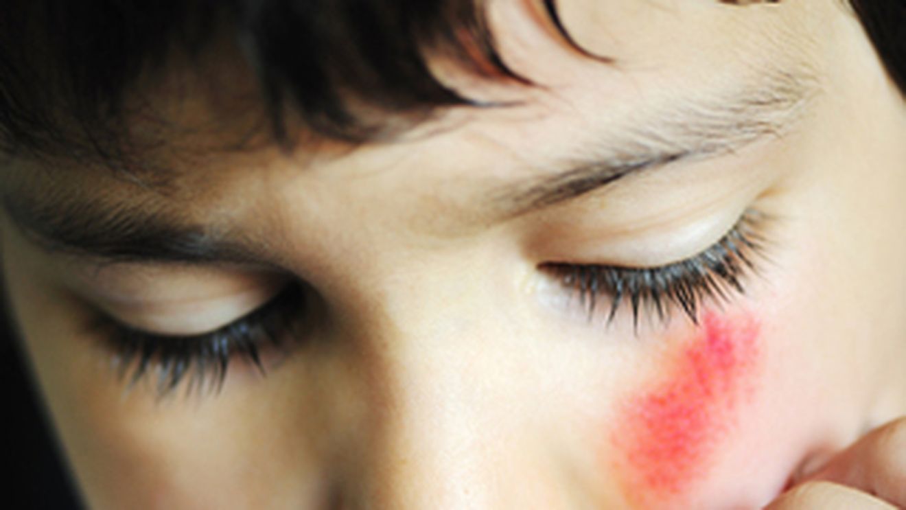 VIDEO Un copil de 5 ani a fost lovit cu toporul in cap, de fratele sau mai mare!