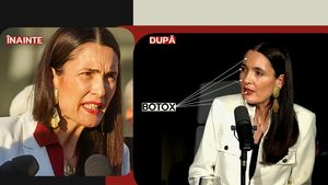 Schimbarea la față! ”Regele liftingurilor” a făcut radiografia: ce intervenții estetice are Clotide Armand?