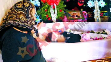 A murit dupa ce i-au pus mana in ghips