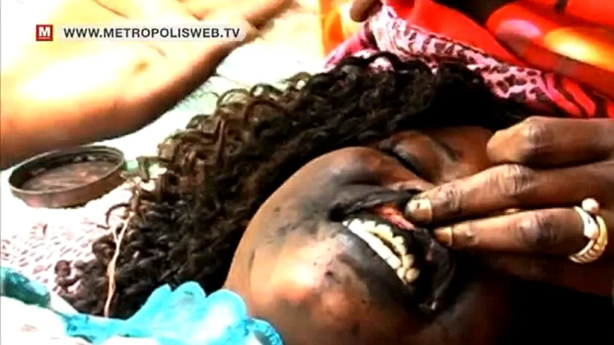 Tratament de înfrumuseţare dureros din Senegal! Femeile îşi tatuează gingiile în negru pentru a avea un zâmbet seducător!