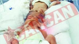 Mama siamezilor e iar insarcinata