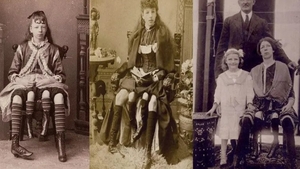 Cazul care a uimit o lume întreagă. Cine este Josephine Myrtle Corbin, femeia cu patru picioare