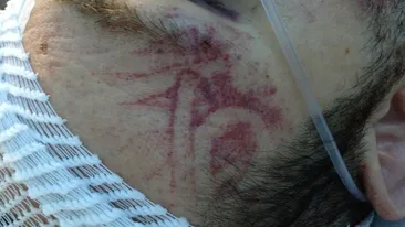 Acum un an, Andrei Tirdea a fost batut de 3 malaci, pe strada! Ce s-a intamplat intre timp cu fostul iubit al Andreei Mantea