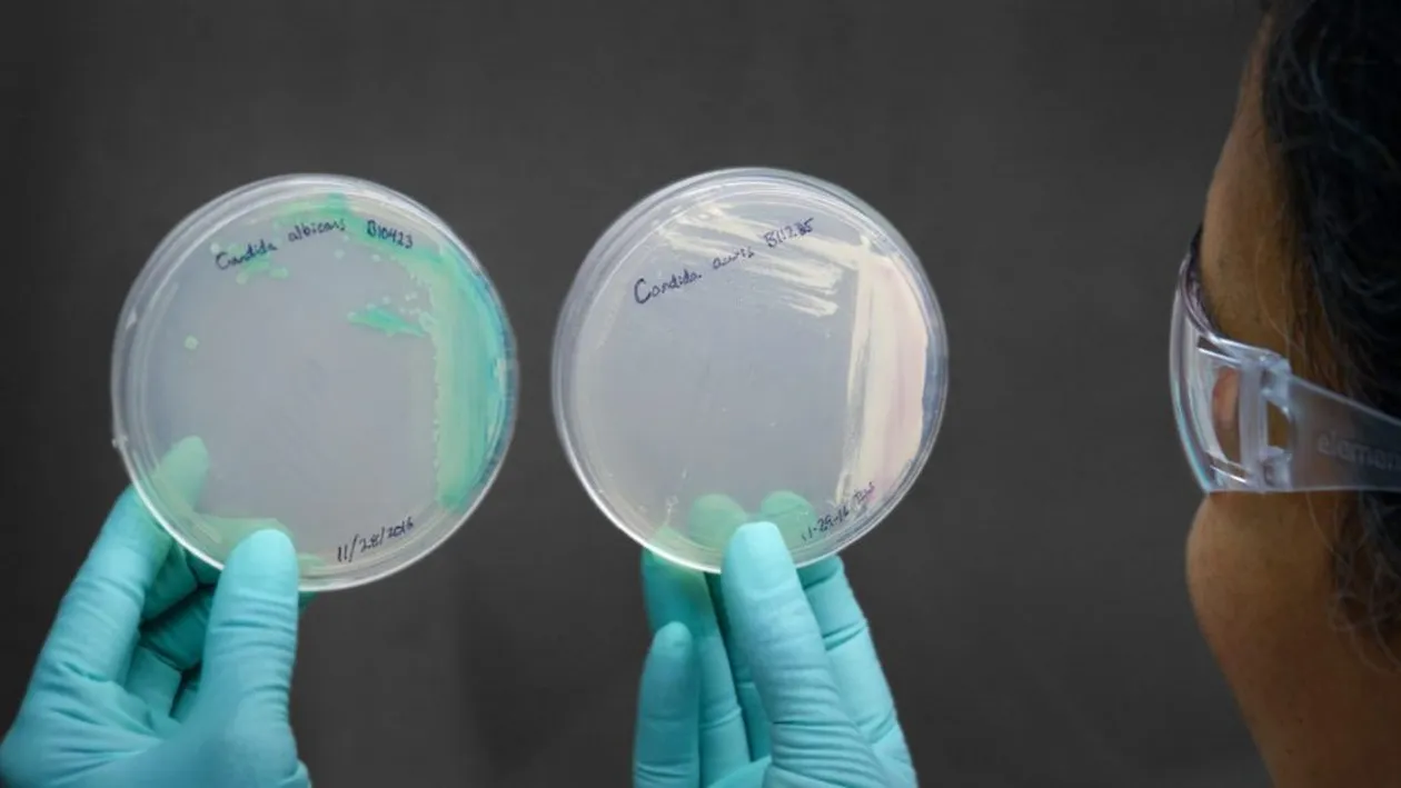 Groaza pune stăpânire pe omenire! Boala care lovește ca ciuma și nimeni n-are o soluție!