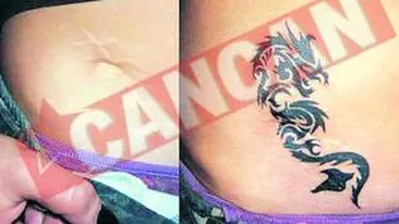 Vedetele isi mascheaza cicatricele cu tatuaje