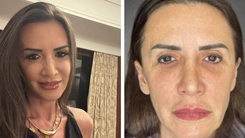 Mara Bănică, mesaj dur pentru cei care au criticat-o că și-a făcut lifting facial: ”Era mai bine să fi spus că m-am apucat de yoga?!”