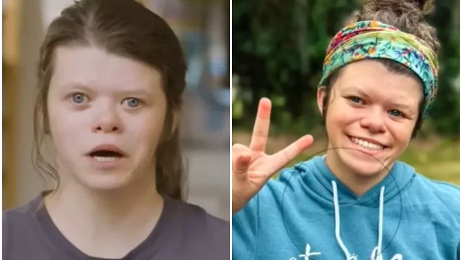 Tânăra din imagine suferă de o afecțiune extrem de rară, se îndrăgostește de oricine! Ce este sindromul Williams și cum se manifestă 