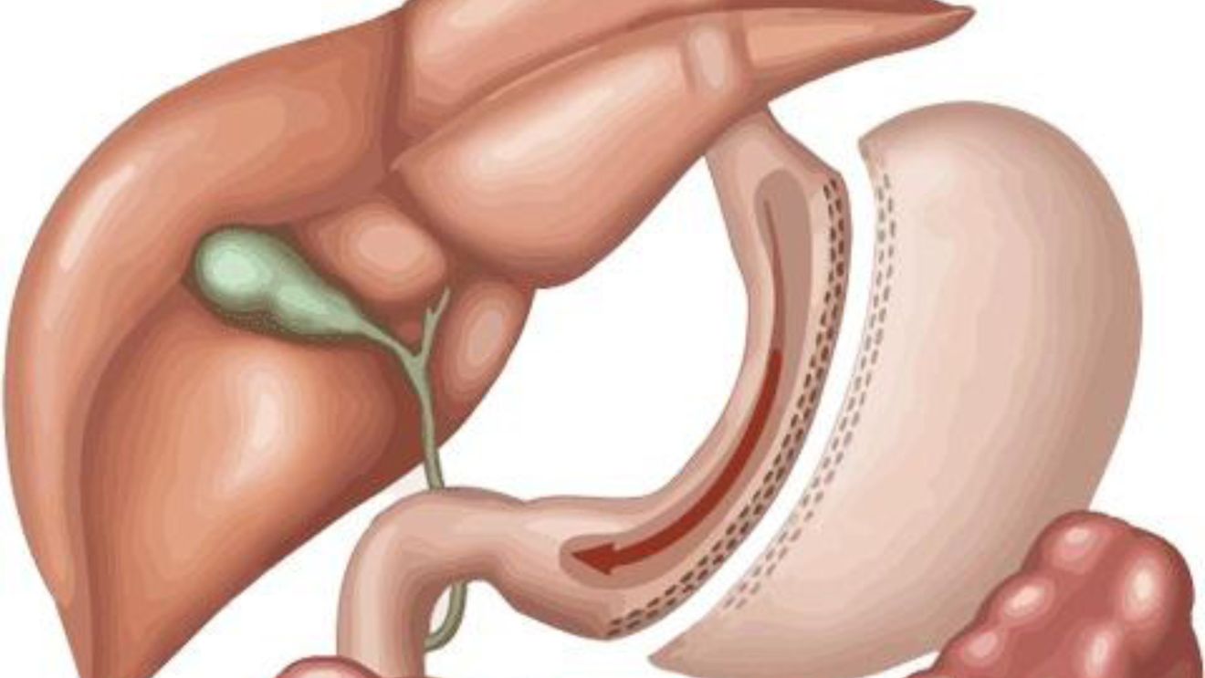 Vedete care şi-au micşorat stomacul. Viaţa li s-a schimbat total după operaţie