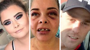 Un bărbat și-a bătut iubita și i-a spart trei dinți din cauză că a schimbat poza de pe Facebook și el nu mai apărea în ea