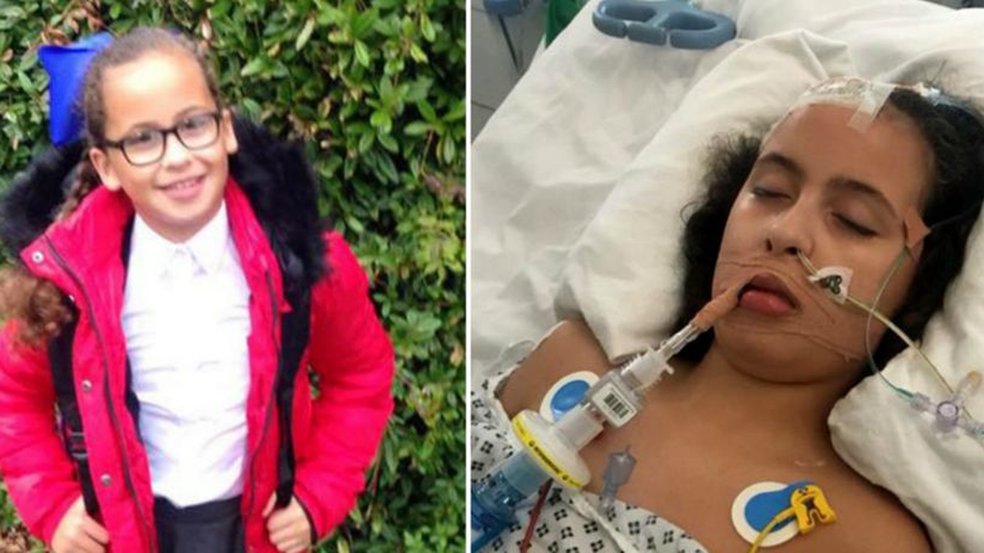 Fetita a inceput sa planga si sa acuze dureri mari de cap! Medicii s-au crucit cand au descoperit ce are de fapt, la varsta de doar 10 ani